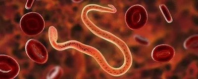 Rashtra Jagrookta | लिम्फेडेमा रोगियों की पहचान और ग्रेडिंग को लेकर आयोजित...