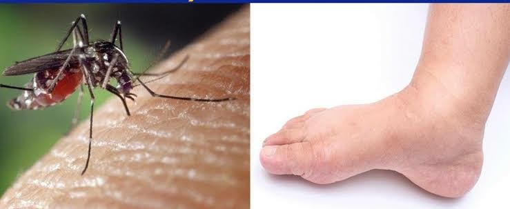 Rashtra Jagrookta | बापू जयंती पर फाइलेरिया एवं कालाजार  को खत्म करने का...